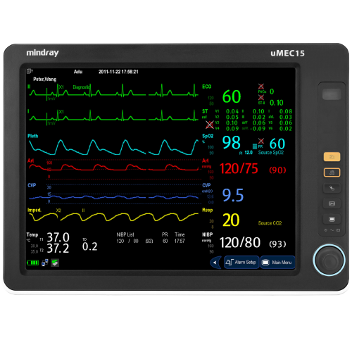Monitor multiparametrico Umec 15 Centro de Servicios Hospitalarios