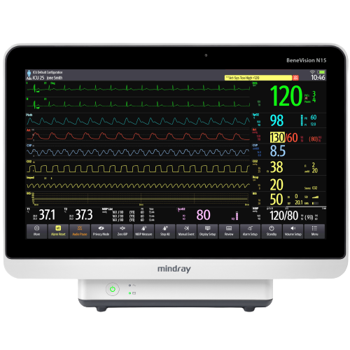 Monitores multiparametricos Benevision N15 Mindray Centro de Servicios Hospitalarios