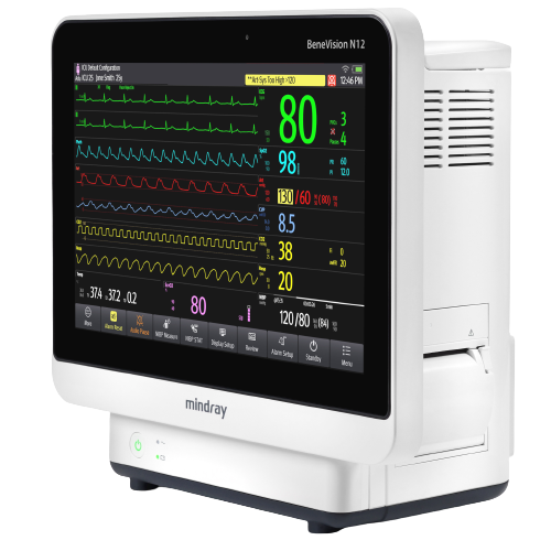 Monitores-Benevision-N12-Mindray-Centro-de-Servicios-Hospitalarios-4