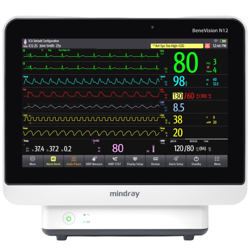 Monitores-Benevision-N12-Mindray-Centro-de-Servicios-Hospitalarios-5