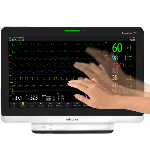 Monitores-multiparametricos-Mindray-Benevision-17-Centro-de-Servicios-Hospitalarios-2-2