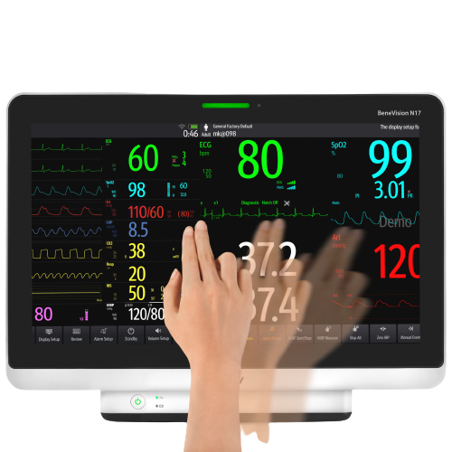 Monitores-multiparametricos-Mindray-Benevision-17-Centro-de-Servicios-Hospitalarios-3-1