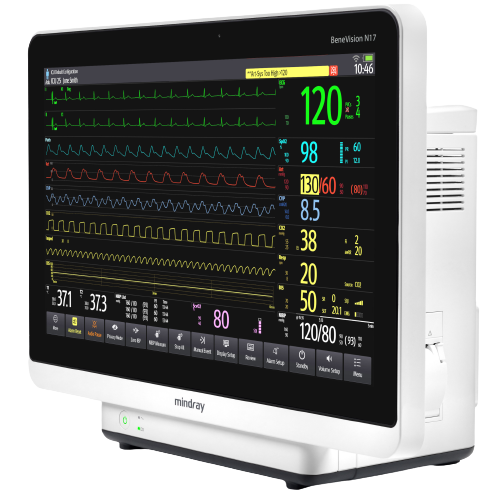 Monitores-multiparametricos-Mindray-Benevision-17-Centro-de-Servicios-Hospitalarios-3