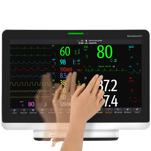 Monitores-multiparametricos-Mindray-Benevision-17-Centro-de-Servicios-Hospitalarios-4