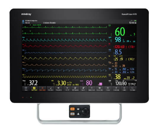 Monitores_Benevision_N19_Mindray_Centro_de_Servicios_Hospitalarios_1-removebg-preview