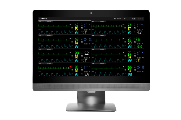 Central-de-Monitoreo-BeneVision-Mindray-Centro-de-Servicios-Hospitalarios-5