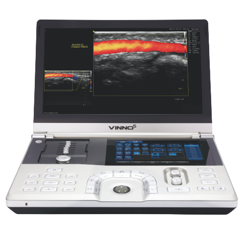 Ecografo-portatil-Vinno-5-Centro-de-Servicios-Hospitalarios-3-1