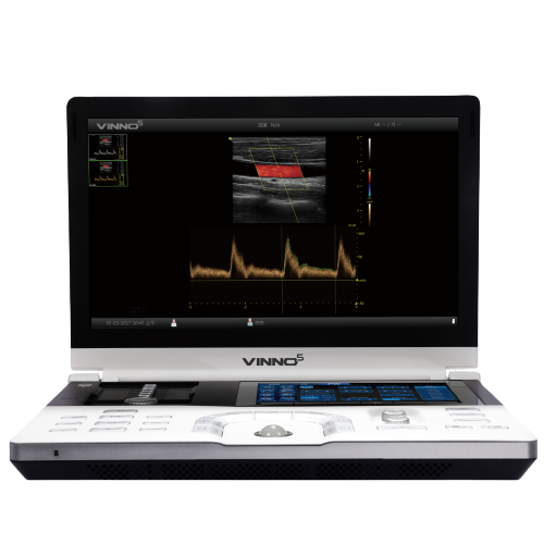 Ecografo-portatil-Vinno-5-Centro-de-Servicios-Hospitalarios-4-1