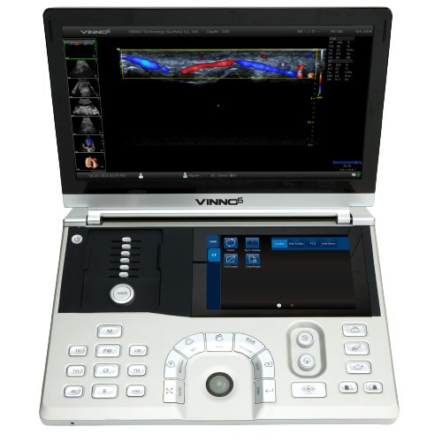 Ecografo-portatil-Vinno-6-Centro-de-Servicios-Hospitalarios-3